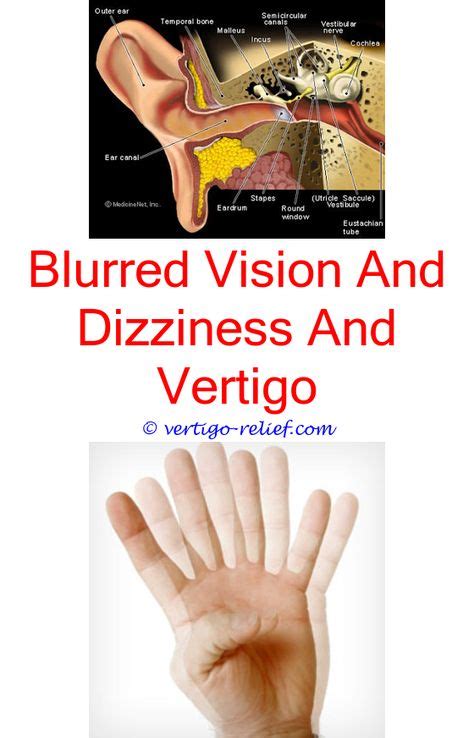 Aleve Side Effects Vertigo (With images) | Vertigo causes, Vertigo ...