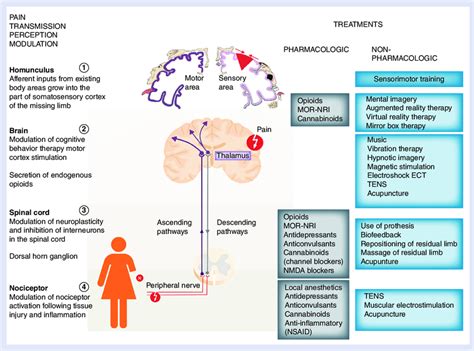 Pain Pathway Concept Maps