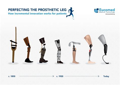 How innovation has perfected the prosthetic leg for the last 200+ years ...