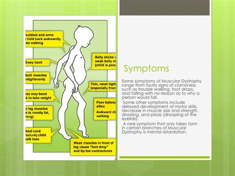 Muscular Dystrophy Types Chart