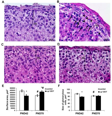 Changes in the histology of the adrenal zona glomerulosa after... | Download Scientific Diagram