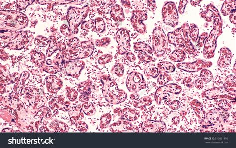 Placenta Cross Section Histology