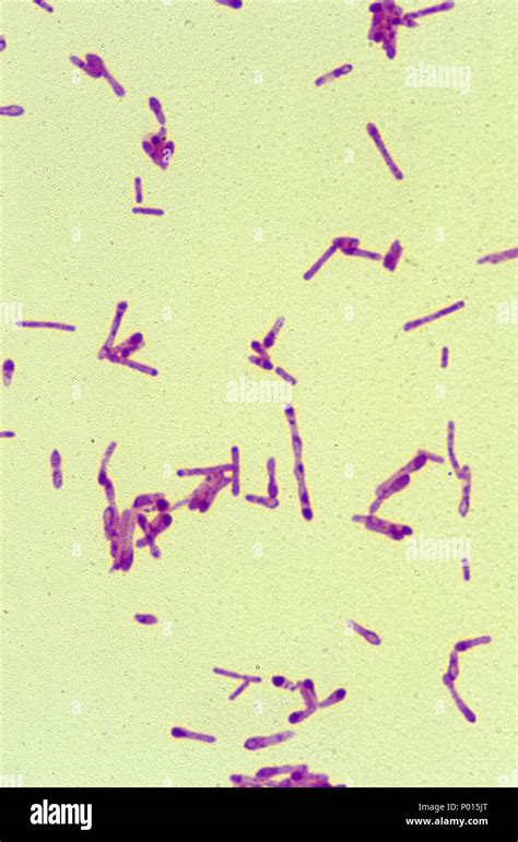 Clostridium Botulinum Under Microscope