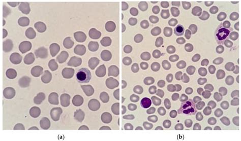 Cells | Free Full-Text | Diagnostic Value and Prognostic Significance of Nucleated Red Blood ...