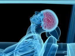 Whiplash: Causes, symptoms, and treatments