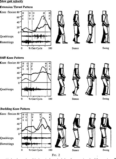 [PDF] Gait Pattern in the Early Recovery Period after Stroke ...