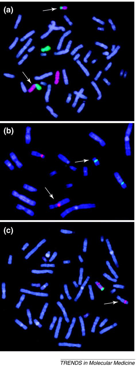 Modern molecular cytogenetic techniques in genetic diagnostics: Trends in Molecular Medicine