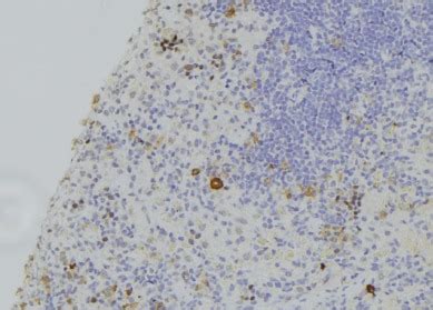 Anti-Gasdermin D / GSDMD Antibody | Rabbit anti-Human Polyclonal | LSBio