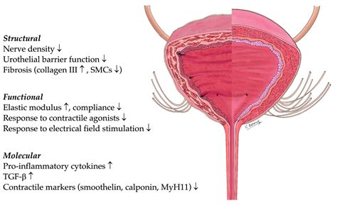 IJMS | Free Full-Text | Neurogenic Lower Urinary Tract Dysfunction in Spinal Dysraphism ...