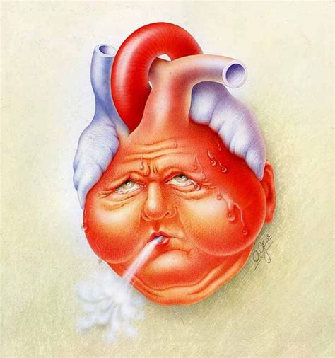 Congestive Heart Failure