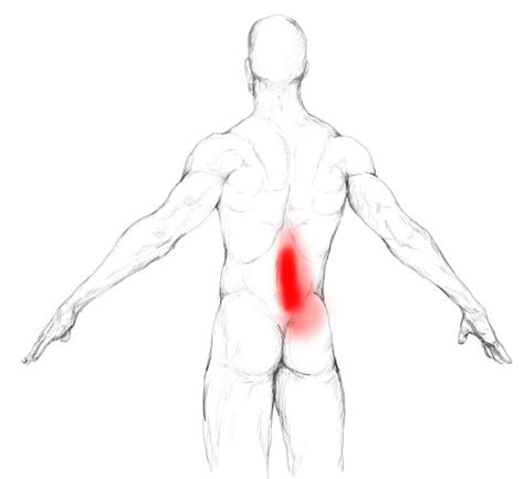 Iliopsoas muscle pain & trigger points