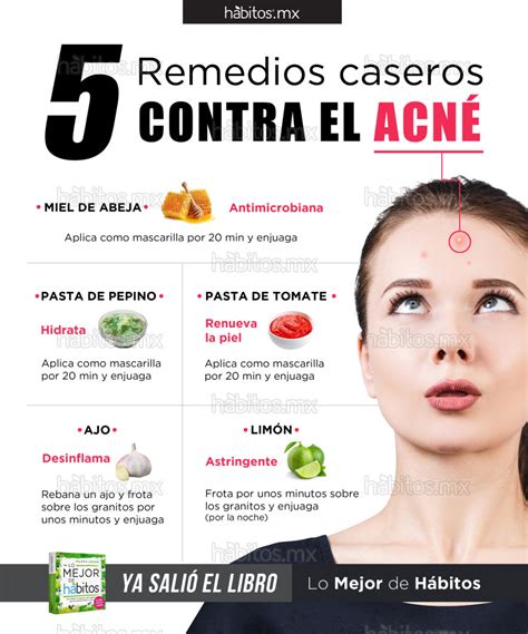 5 remedios caseros contra el Acné – Hábitos Health Coaching