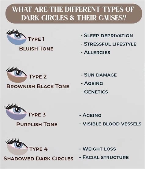 Dark Circles Begone: Expert Tips and Medical Treatments for Clearer ...