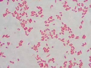 Biochemical Test of Serratia marcescens