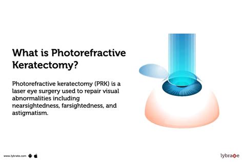 Photorefractive Keratectomy: Causes, Symptoms, Treatment and Cost