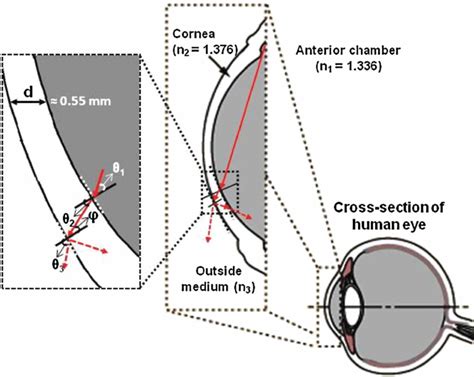 Note: A gel based imaging technique of the iridocorneal angle for evaluation of angle-closure ...