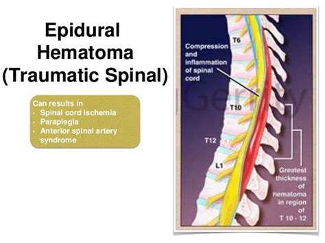 COMPLICATIONS OF SPINAL & EPIDURAL ANAESTHESIA