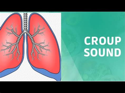 Croup sound| Croup cough Sound| Barking cough sound - YouTube