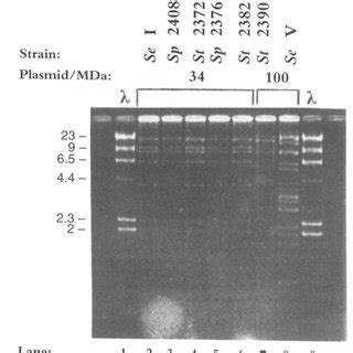 EcoRI restriction enzyme lgests of the ampicillin-resistant... | Download Scientific Diagram