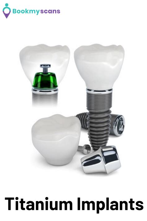 Titanium Implants:-Generally, Titanium is used for bone fractures as well as for Dental Works ...