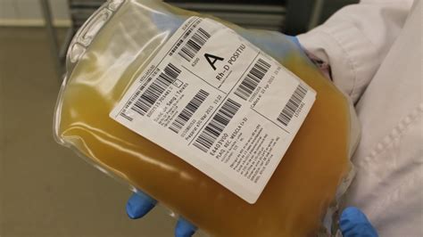 Platelet donations urgently needed | Info Barcelona | Barcelona City Council