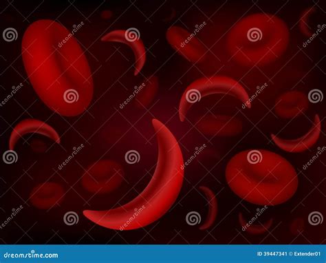 Sickle-cell and Normal Red Blood Cells Stock Illustration ...