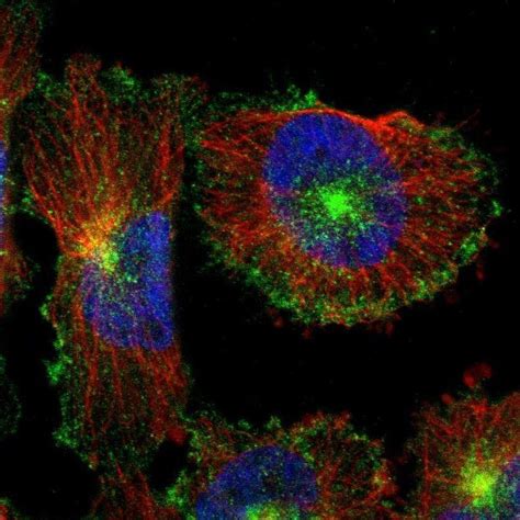 Tips for Optimizing Immunofluorescence Protocols to Get the Best Image