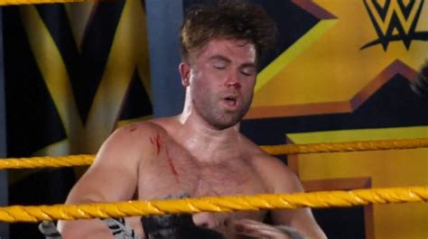 Tyler Breeze Busted Open By Brutal Super Kick At NXT Show (VIDEO ...