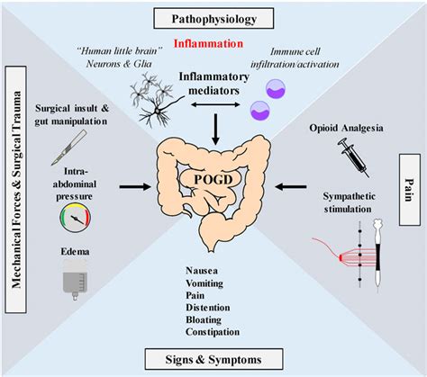 Frontiers | Postoperative Ileus and Postoperative Gastrointestinal Tract Dysfunction: Pathogenic ...