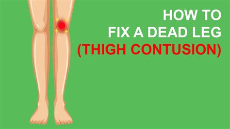 How To Heal A Dead Leg - Trackreply4