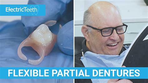 how do flexible partial dentures stay in place - Cherise Guyton