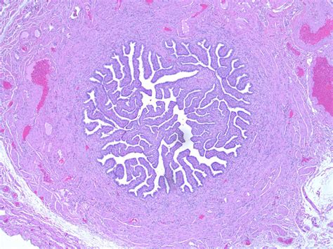 Pathology Outlines Anatomy Histology Embryology Features To Report ...