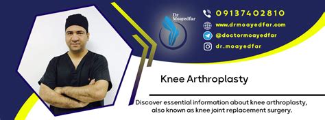 The best knee arthroplasty surgery doctor in Iran