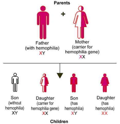 Hemophilia - The Missing Factor