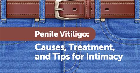 Penile Vitiligo: Causes, Treatment, and Tips for Intimacy | MyVitiligoTeam