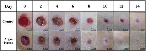 Wound Healing Before And After