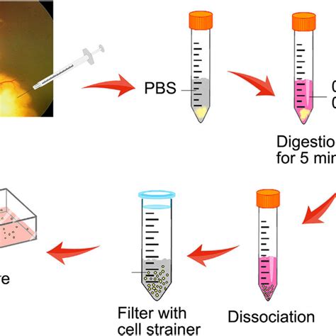 In vitro culture of primary cells and cell-lines of retinoblastoma ...