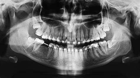 Radiologie dentaire | Centre de radiologie Sud Rhône Imagerie