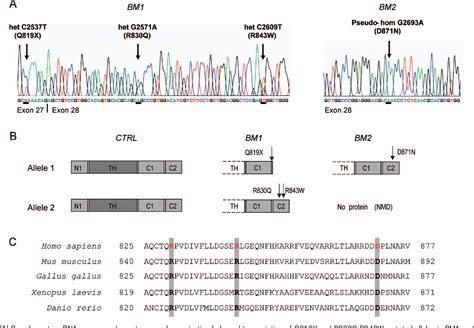 Figure 2 from Autosomal recessive Bethlem myopathy | Semantic Scholar