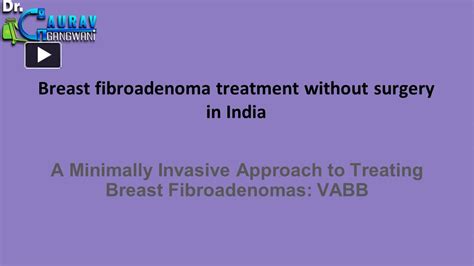 PPT – Breast fibroadenoma treatment without surgery in India PowerPoint presentation | free to ...