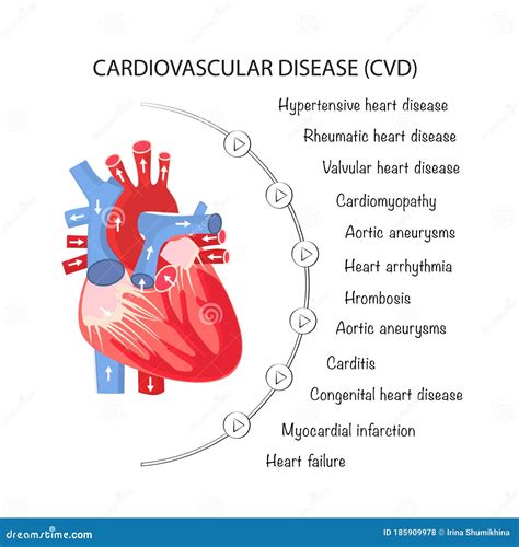 types of vascular disease Cardiovascular types disease diseases cvd prevention causes different ...