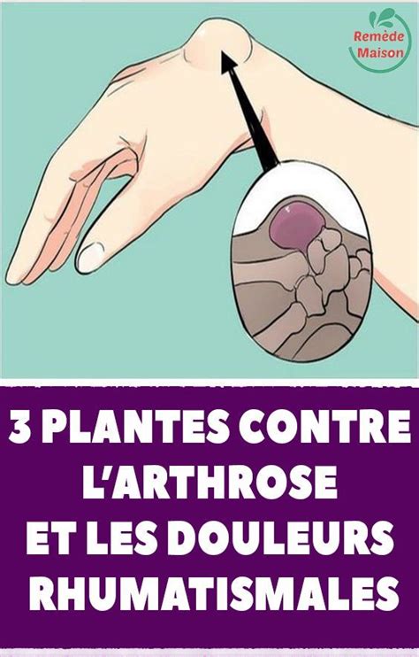 3 plantes contre l’arthrose et les douleurs rhumatismales | Remède contre l arthrose