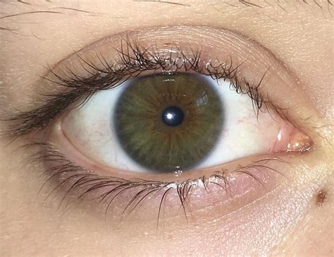 hazel or central heterochromia? : r/eyes