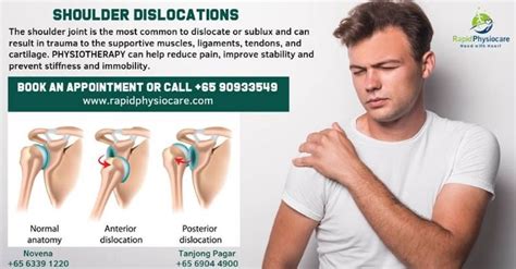 best physiotherapy Singapore | Shoulder dislocation, Physiotherapy ...