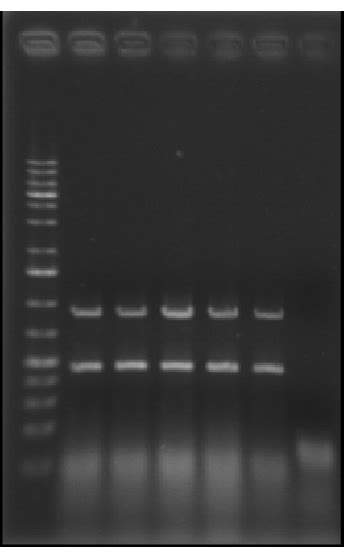 RT-PCR revealed 879 bp of the partial citrinin biosynthesis gene... | Download Scientific Diagram