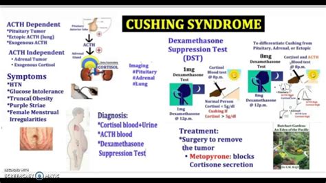 Cushing Syndrome - causes, symptoms, diagnosis, treatment, pathology in ...