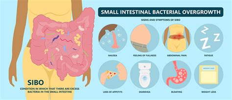 Small Intestinal Bacterial Overgrowth (SIBO)