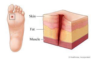 Will you Get Tetanus if you Step on a Rusty Nail? » Science ABC