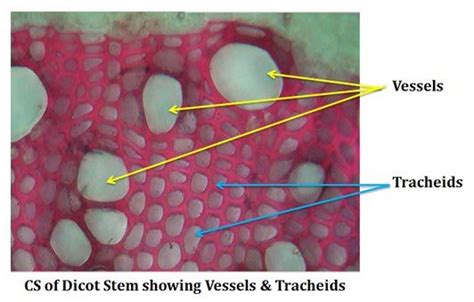 what is tracheid Similarities And Differences, Similarity, Botany, Different, Vessel, Microscope ...