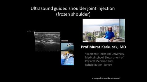 Ultrasound guided shoulder joint injection (frozen shoulder) - YouTube